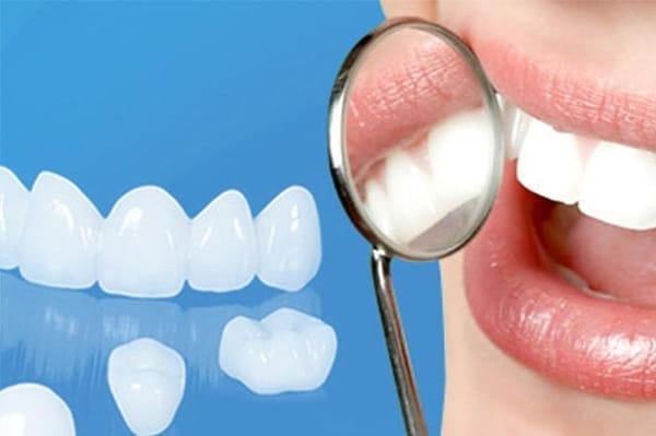 răng toàn sứ Zirconia